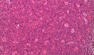 Image of a biopsy slide 