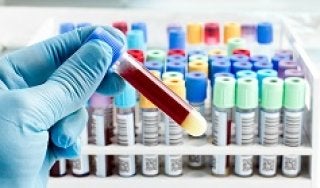 Image of hand holding vial of blood