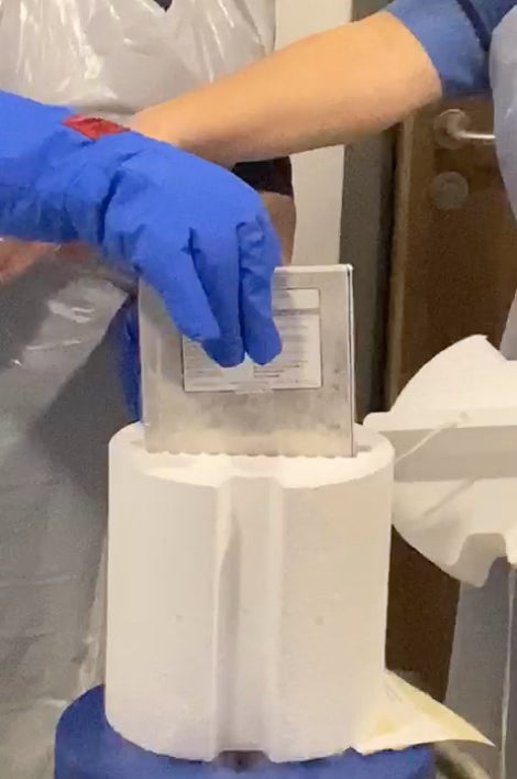CAR T cell within frame
