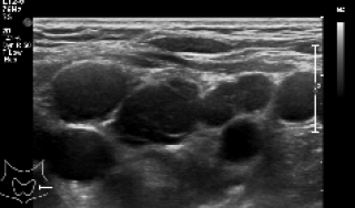 Image of an ultrasound scan